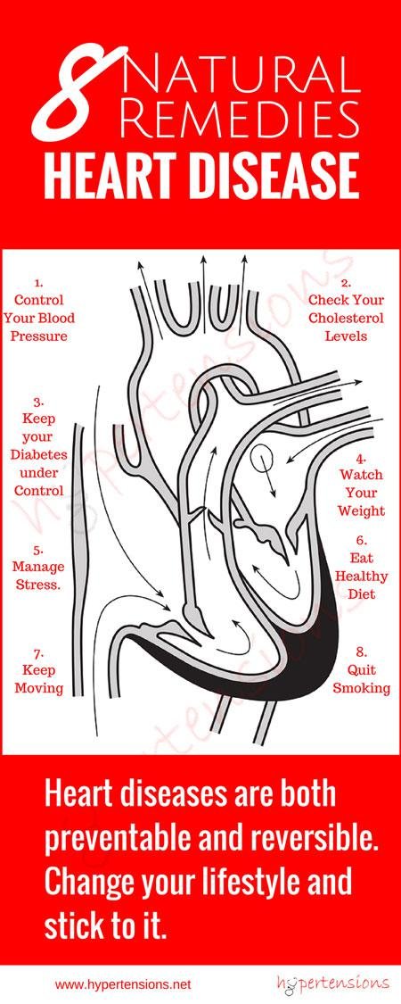 heart disease remedies infographic